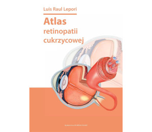 Atlas retinopatii cukrzycowej