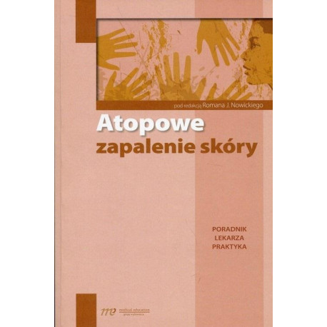 Atopowe zapalenie skóry. Poradnik lekarza praktyka