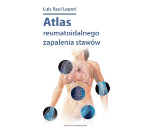 Atlas reumatoidalnego zapalenia stawów