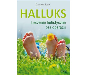 Halluks. Leczenie holistyczne bez operacji