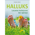 Halluks. Leczenie holistyczne bez operacji