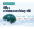 Atlas elektroencefalografii